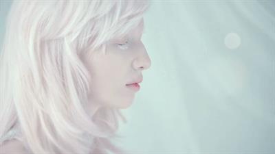 Beautiful albinos model