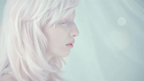 Beautiful albinos model