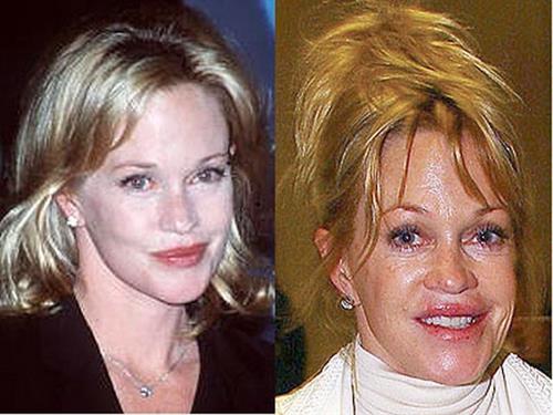 Melanie Griffith