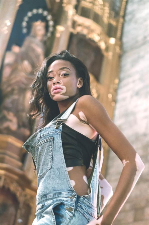 Winnie Harlow