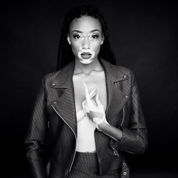 Winnie Harlow