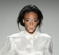 Winnie Harlow