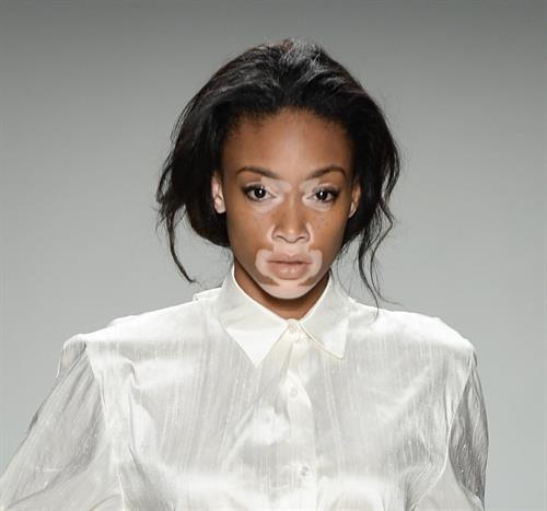 Winnie Harlow