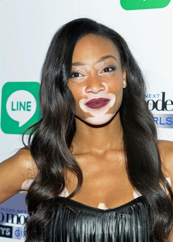 Winnie Harlow