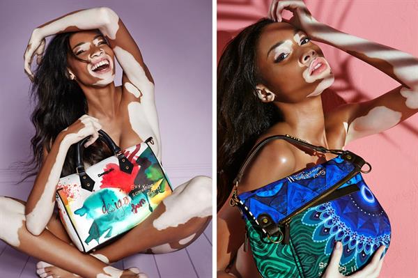 Winnie Harlow