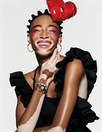 Winnie Harlow