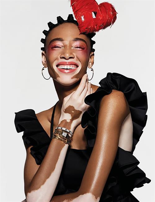 Winnie Harlow