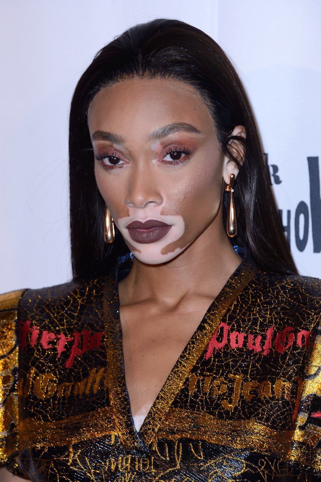 Winnie Harlow