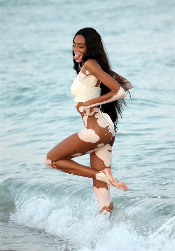 Winnie Harlow