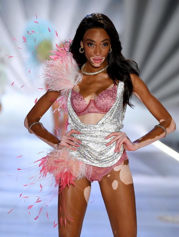 Winnie Harlow