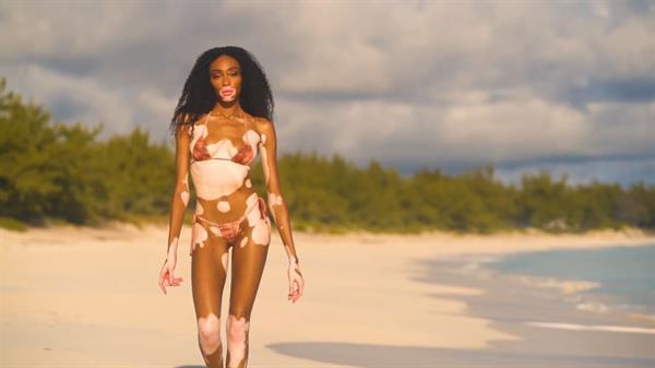 Winnie Harlow in a bikini